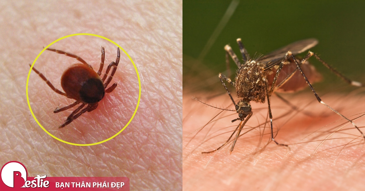 Bí quyết để làm dịu vết côn trùng: kiến ba khoang, muỗi, bọ chó,... đốt